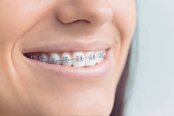 Dental Bonding in Truckee, CA